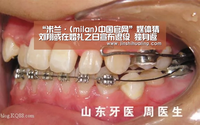 “米兰·(milan)中国官网”媒体猜刘翔或在婚礼之日宣布退役 独身返沪笑容尴尬(图1) 米兰·(milan)中国官网